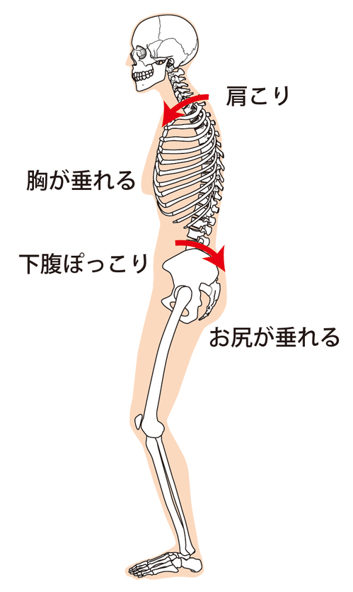 腰痛のいろいろ3