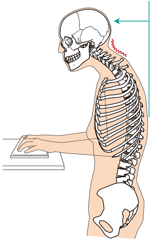 ストレートネックは姿勢の生活習慣の改善がカギになる